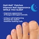 thumbnail image 4 of Parches renovadores de uñas para hongos Opti-Nail 21 (paquete de 2), 4 of 5