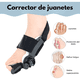 thumbnail image 3 of Corrector De Juanetes Feetifix Ortopédico Ajustable 1 Un, 3 of 7