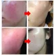 thumbnail image 2 of 7 Day Repair Facial Redness Cream Soothing Redness Repair Skin Rosacea Red Blood Improve Sensitive Skin CareKorean Cosmetic 40ml, 2 of 3
