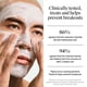 thumbnail image 4 of Mascarilla facial Neutrogena Univerly Clear Acne con peróxido de benzoilo al 3,5%, 4 of 9
