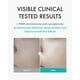 thumbnail image 2 of Mascarilla Rejuran Turnover Mask C-pDRN Skin Repair 40 ml x 5, 2 of 2