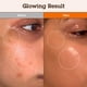 thumbnail image 3 of Serum BLITHE Niacinamida 5% + Ácido Tranexámico 3% para manchas oscuras, 3 of 8