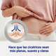 thumbnail image 4 of Pack 6 Parches De Silicona Para Cicatrices Cesarea Cirugia, 4 of 6