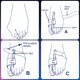 thumbnail image 4 of Regulador de Juanetes PediFix Talla Mediana Pie Derecho, 4 of 4