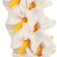 thumbnail image 2 of Modelo anatómico de columna lumbar con sacro y nervios espinales, réplica didáctica que muestra la sección lumbosacro con nervios y disco herniado en L4 - Incluye base para exhibición, 2 of 9
