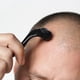 thumbnail image 5 of Microaguja Derma Roller ROSELYNBOUTIQUE de 0,25 mm 540 (negra), 5 of 7
