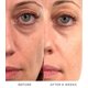 thumbnail image 4 of Suero Facial Noble Panacea Prime Radiance 7 Dosis, 4 of 9