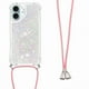 thumbnail image 2 of Funda FOXDOCK para iPhone 16 con Cuerda Ajustable, Brillo Líquido, Protección Antigolpes y Lente – Ideal para Regalo, 2 of 6