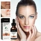 thumbnail image 3 of Sérum facial Weslaplus 2024 corrector de melanina 30 ml (3 unidades), 3 of 6