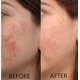 thumbnail image 4 of Serum Dr. Brenner con vitamina C, 20% de ácido L-ascórbico puro, juego de 2, 4 of 6