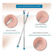 thumbnail image 2 of Kit Extractor De Comedones Espinillas 4 Piezas Doble Cabezal, 2 of 4