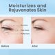 thumbnail image 3 of Crema para ojos SKIN LAB BY BSL Hydrate & Replenish con ácido hialurónico, 3 of 6