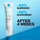 thumbnail image 5 of Crema para el tratamiento del acné La Roche-Posay Effaclar Duo+M 40 ml, 5 of 9
