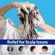 thumbnail image 2 of Shampoo Tuymec Psoriasis, Dermatitis seborreica, foliculitis, 2 of 3