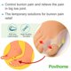 thumbnail image 3 of Almohadilla para juanetes Povihome Pack de 8 (1,3 cm) Escudo de gel, 3 of 6