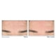 thumbnail image 3 of Limpiador facial RoC Retinol Correxion Serum para arrugas profundas 180 mL, 3 of 5