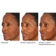 thumbnail image 5 of Suero NASSIFMD Potenciador de Luminosidad Vitamina C 30 ml, 5 of 7