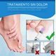 thumbnail image 5 of Lápiz Láser Reparador De Uñas Para Onicomicosis Con Láser, 5 of 7