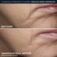 thumbnail image 4 of Crema rica en arrugas profundas Cream RoC, 50 ml, sin fragancia, 4 of 9