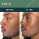 thumbnail image 2 of Sérum facial hidratante KRETE 30 segundos para hombres de todo tipo de piel, 2 of 2