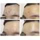 thumbnail image 4 of Gel Aloe Vera Antiacne  Hidratante Calmante 300 g, 4 of 5