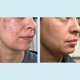 thumbnail image 3 of Gel Peel Perfect Image Ácido glicólico 50% con retinol 30 ml, 3 of 9