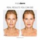 thumbnail image 5 of Crema Correctora de Manchas Oscuras Instaderm 50 ml Vitaminas C y E, 5 of 9