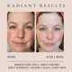 thumbnail image 3 of Suero facial SAINT JANE 30 ml Gotas de Brillo con Vitamina C, 3 of 8