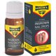 thumbnail image 1 of Tratamiento para uñas encarnadas URIEL UPGRADE 20 ml, 1 of 9