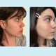thumbnail image 5 of Gel Peel Perfect Image Ácido glicólico 50% con retinol 30 ml, 5 of 9