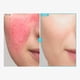 thumbnail image 3 of Crema de zinc TOSOWOONG SOS Repair CICA Clinic Zinc 50 g 50 ml, 3 of 7