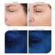 thumbnail image 5 of Suero facial MICHAEL TODD KNU 30 ml Levantador y Iluminador, 5 of 7