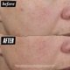 thumbnail image 5 of Sérum corrector de color Kiehl's Auto-Tone Decoloración SPF30, 5 of 8