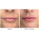 thumbnail image 3 of Tratamiento labial City Beauty City Lips Night Oil Antiedad, 3 of 8
