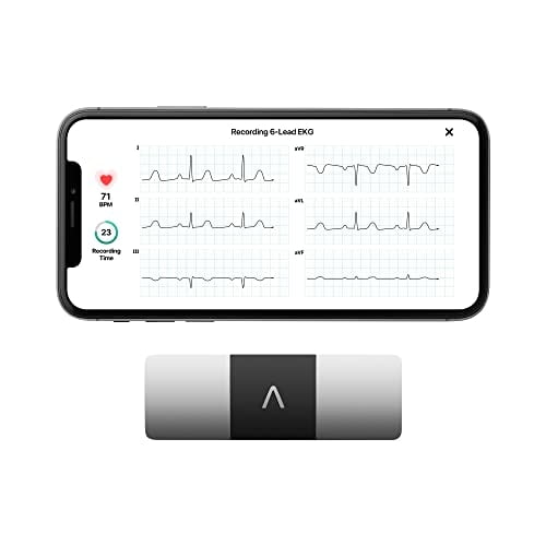Monitor de electrocardiograma AliveCor KardiaMobile personal de 6 derivaciones con fibrilación auric