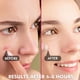 thumbnail image 2 of Parches para espinillas Albatross Health New England, 180 unidades, 2 of 7