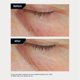thumbnail image 5 of Crema para ojos Revision Skincare C+ Brightening Eye Complex, 5 of 6