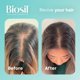 thumbnail image 3 of Suplemento Biosil Collagen Generator, 15 ml, 2 unidades, 3 of 3
