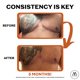 thumbnail image 4 of Cinta adhesiva Motivo Scar Care, rollo de 200 cm x 2,5 cm (20 tiras), 4 of 7