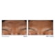 thumbnail image 4 of Limpiador facial RoC Retinol Correxion Serum para arrugas profundas 180 mL, 4 of 5