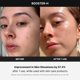 thumbnail image 3 of Dispositivo de tratamiento facial Medicube Age-R Booster-H, 3 of 3