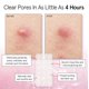 thumbnail image 3 of Pimple Patches Grace & Stella, HSA, 72 unidades, ganadores del premio FSA, 3 of 9