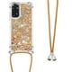thumbnail image 1 of Funda FOXDOCK para Xiaomi Redmi Note 12s 4G con Cuerda Ajustable, Brillo Líquido, Protección Antigolpes y Lente – Ideal para Regalo, 1 of 6