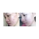 thumbnail image 2 of Crema anti acné LAVIDERM con ácido láctico, ácido salicílico y escualeno, 2 of 2