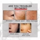 thumbnail image 3 of Sérum antienvejecimiento YG LianKai EELHOE Collagen Boost 90 ml x3, 3 of 7