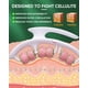 thumbnail image 2 of Rodillo Masajeador ONUEMP Eliminador de Celulitis, 2 of 3