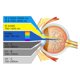 thumbnail image 5 of Gafas de seguridad Cloudray 10600 nm OD 6+ certificadas CE, 5 of 8
