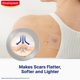 thumbnail image 3 of Yesos reductores de cicatrices, tratamiento de cicatrices con elastoplasto, 21 piezas, 3 of 6
