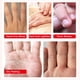 thumbnail image 3 of Guantes hidratantes AIQIUSHA, máscara de spa para manos, colágeno, paquete de 4, 3 of 7