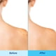 thumbnail image 3 of Spray corporal para el acné Differin 360 con ácido salicílico 180 ml, 3 of 8